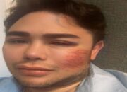 Desainer Ivan Gunawan Unggah Foto Wajah Dirinya yang Luka Lebam, Ada Apa?
